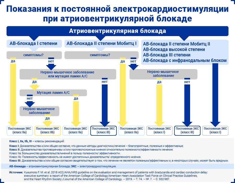 Показания к постоянной электрокардиостимуляции при атриовентрикулярной блокаде